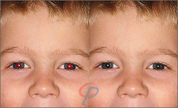 Red Eyes Effect Fixing