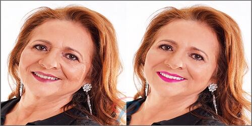 Face Wrinkles Retouching Service